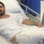 Cyklistovi vzplál iPhone 6 a způsobil popáleniny třetího stupně
