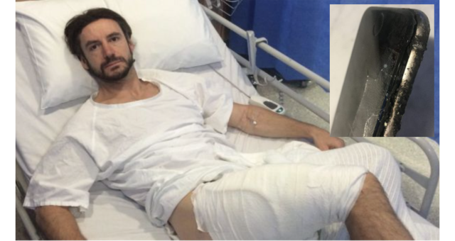 Cyklistovi vzplál iPhone 6 a způsobil popáleniny třetího stupně