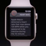 Uživatel Reddit sdílel, že mu Apple Watch zachránily život a díky nim odhalil supraventrikulární tachykardii